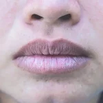 5 Cara Mencegah Bibir Menghitam Akibat Rokok