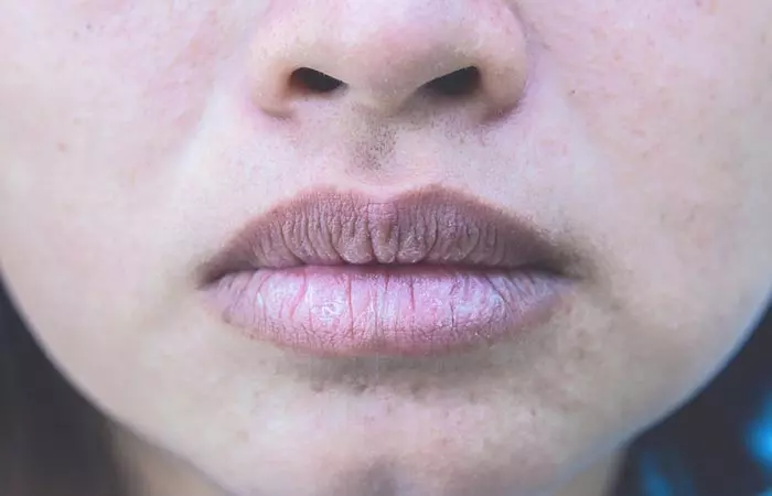 5 Cara Mencegah Bibir Menghitam Akibat Rokok