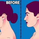 5 Latihan Ringan untuk Mengurangi Lemak di Dagu