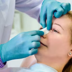 7 Langkah Merawat Hidung Pasca Operasi Sinus