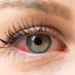 10 Cara Menghindari Iritasi Mata di Lingkungan Berdebu