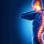 7 Tips Pemulihan Cepat Setelah Cedera Tulang Belakang