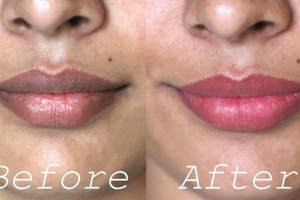 10 Cara Alami Menghilangkan Warna Gelap pada Bibir