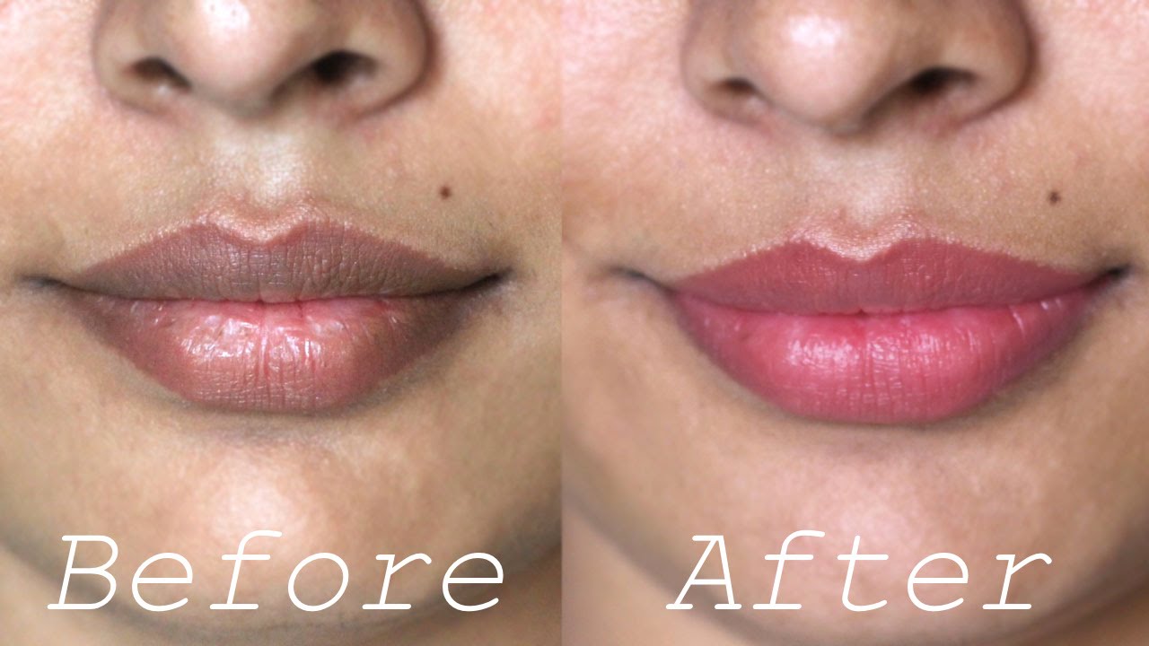 10 Cara Alami Menghilangkan Warna Gelap pada Bibir